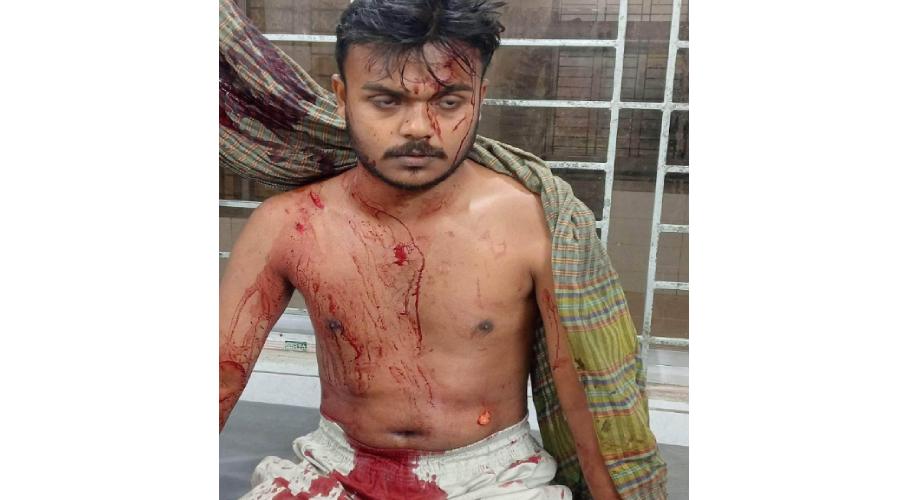 ফরিদগঞ্জে ‘হ্যাঁ–না’ ভোট নিয়ে বিরোধের জেরে ছুরিকাঘাতে যুবক আহত ভোট