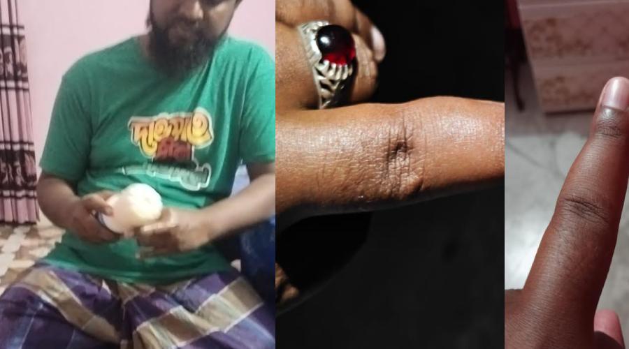 ফরিদগঞ্জে পরিকল্পিত হামলায় আহত ২