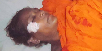 চাঁদপুরে পরিত্যক্ত বোমা বিস্ফোরণে নারী আহত